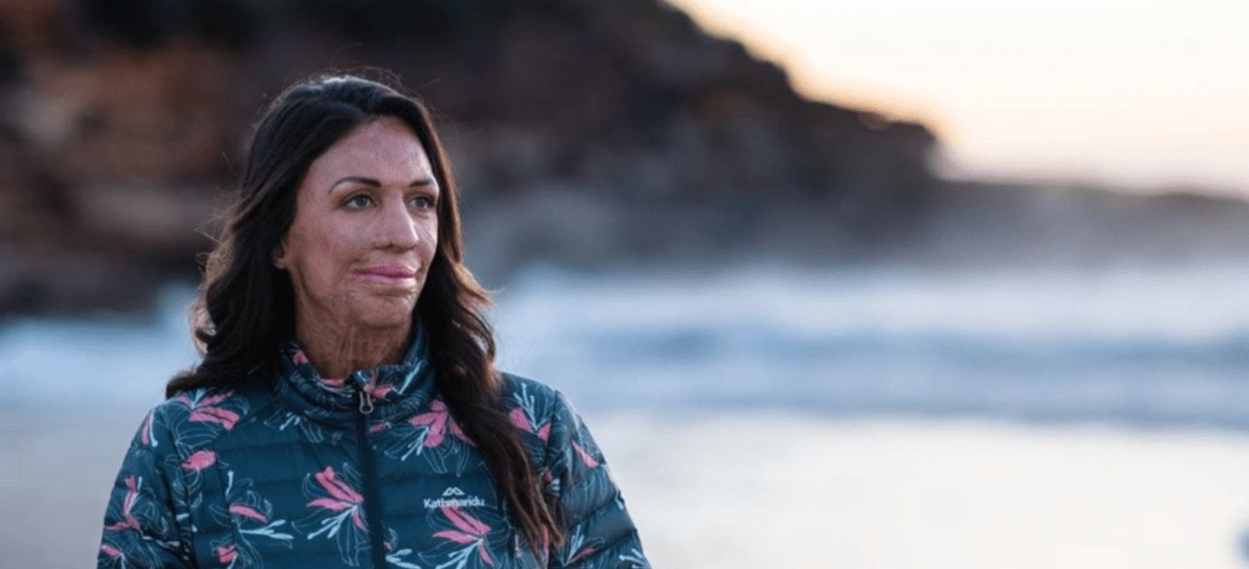 the Sit. Blog Turia Pitt Our Stories About Ourselves by Mike Sherpa Britton